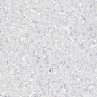 Anti-C11orf87 Antibody