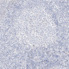 Anti-C11orf87 Antibody