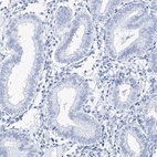 Anti-TSPYL6 Antibody