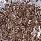 Anti-RMDN2 Antibody