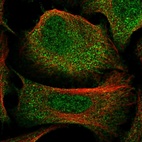 Immunofluorescent staining of human cell line U-2 OS shows localization to nucleoplasm, plasma membrane & cytosol.