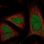 Anti-RNASEH1 Antibody