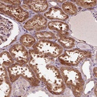 Anti-PCDHGB3 Antibody