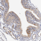 Anti-NELL2 Antibody