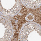 Immunohistochemical staining of human testis shows moderate cytoplasmic positivity in Leydig cells.