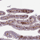 Anti-ITGAE Antibody