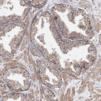 Anti-NGLY1 Antibody