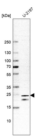 Anti-TMEM9B Antibody