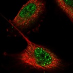 Anti-ZNF551 Antibody