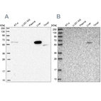 Anti-SUOX Antibody