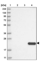 Anti-CLEC3B Antibody