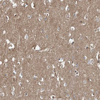 Anti-EPHX4 Antibody