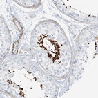 Anti-SMCP Antibody