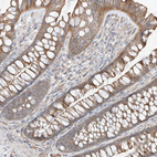 Anti-EPHX4 Antibody