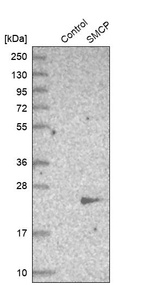 Anti-SMCP Antibody