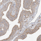 Anti-EPHX4 Antibody