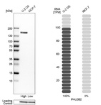 Anti-PHLDB2 Antibody