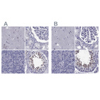 Anti-GKAP1 Antibody