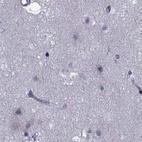 Anti-GKAP1 Antibody