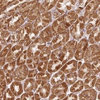 Anti-EFHC1 Antibody