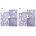 Anti-CCDC39 Antibody