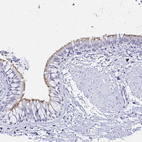 Anti-CCDC39 Antibody