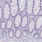 Anti-CCDC39 Antibody