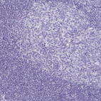 Anti-CCDC39 Antibody