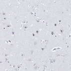 Anti-RPF2 Antibody