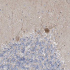 Anti-ADAT2 Antibody