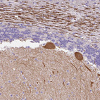 Immunohistochemical staining of human cerebellum shows moderate cytoplasmic positivity in Purkinje cells.