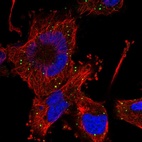 Anti-HFM1 Antibody