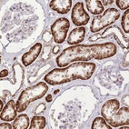 Anti-SLC4A4 Antibody