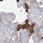 Anti-ADAMTSL3 Antibody