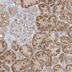 Anti-ADAMTSL3 Antibody