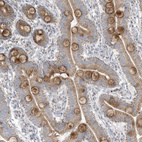 Anti-ADAMTSL3 Antibody