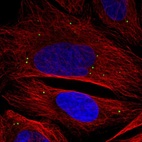 Anti-ADAMTSL3 Antibody