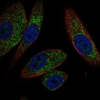 Anti-EFHB Antibody