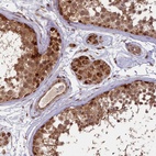 Anti-SHPRH Antibody