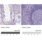 Anti-PLK5 Antibody