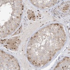 Anti-ZCWPW2 Antibody