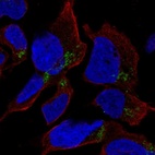 Anti-HFM1 Antibody