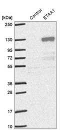 Anti-ETAA1 Antibody