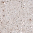 Anti-ETAA1 Antibody