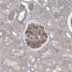 Immunohistochemical staining of human kidney shows strong membranous positivity in cells in tubules.