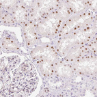 Immunohistochemical staining of human kidney shows moderate nuclear positivity in cells in tubules.