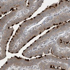 Anti-ZBTB3 Antibody