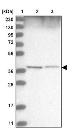 Anti-WDR92 Antibody