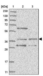 Anti-WDR92 Antibody