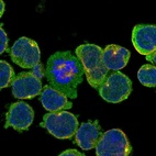 Anti-ECM2 Antibody